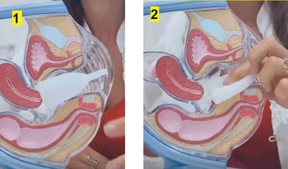 2. Al retirarla, un consejo es usar el dedo para apretar ligeramente el objeto y disminuir el vacío