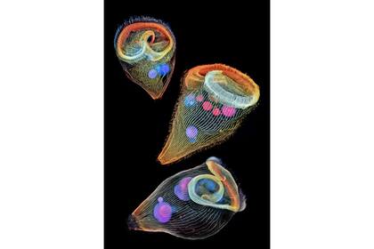 2. Tres protozoos (Igor Siwanowicz, Estados Unidos)