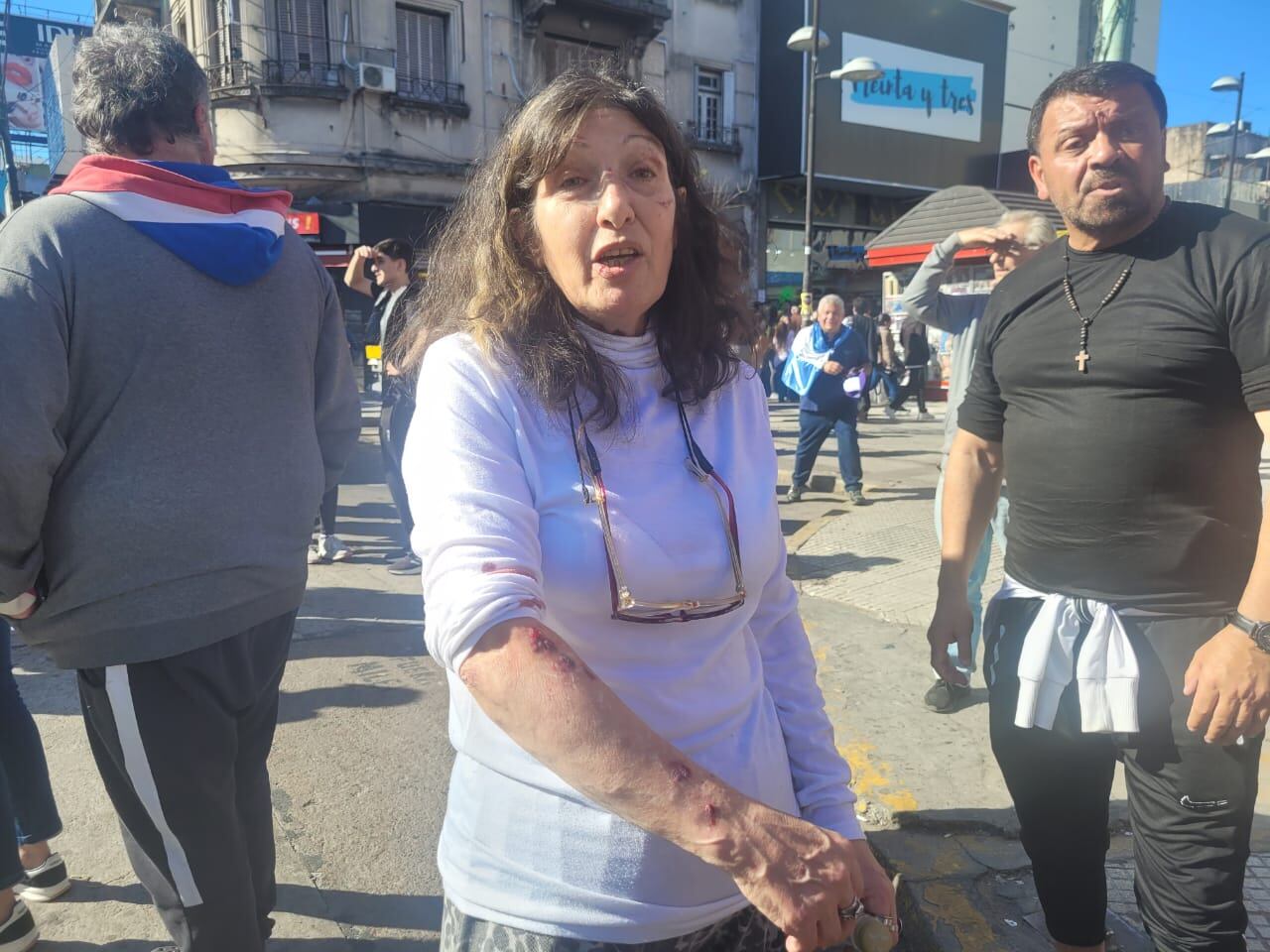 Una militante de LLA muestra las heridas que le dejó una agresión de una mujer en Lomas