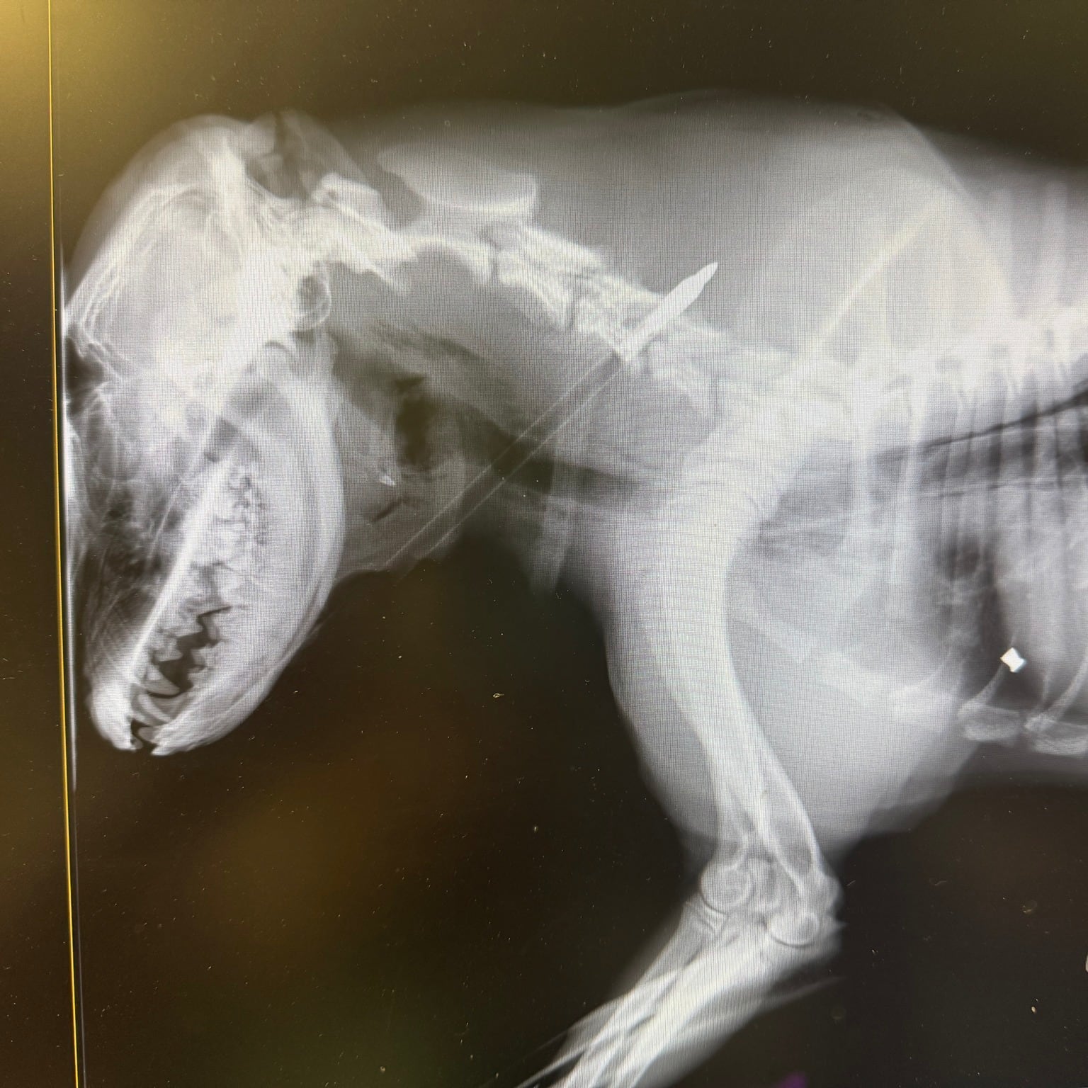 La flecha había quedado encajada cerca de su columna vertebral y esófago.