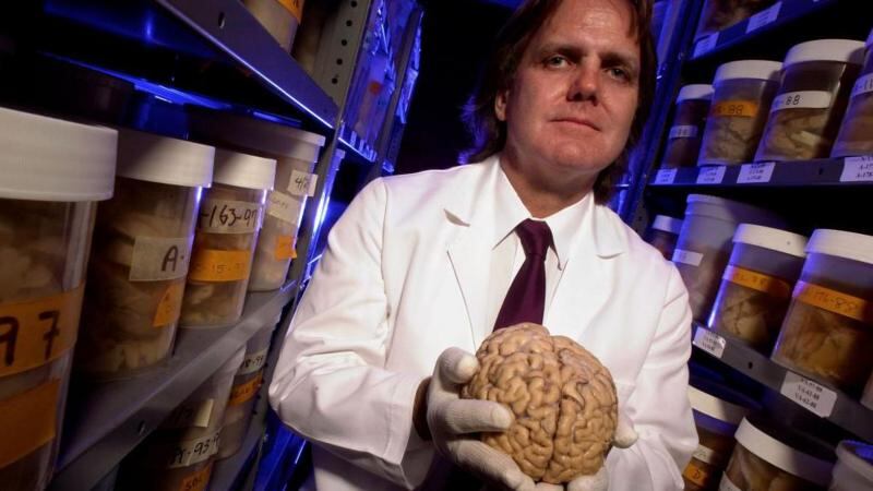 Los secretos sobre nuestro cerebro que reveló uno de los más singulares y ambiciosos estudios
