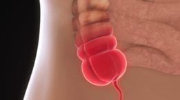 El apéndice es una pequeña prolongación del intestino grueso