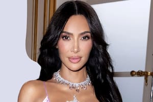 Qué es el “facial vampiro”: se lo aplica Kim Kardashian y tiene poderosos efectos