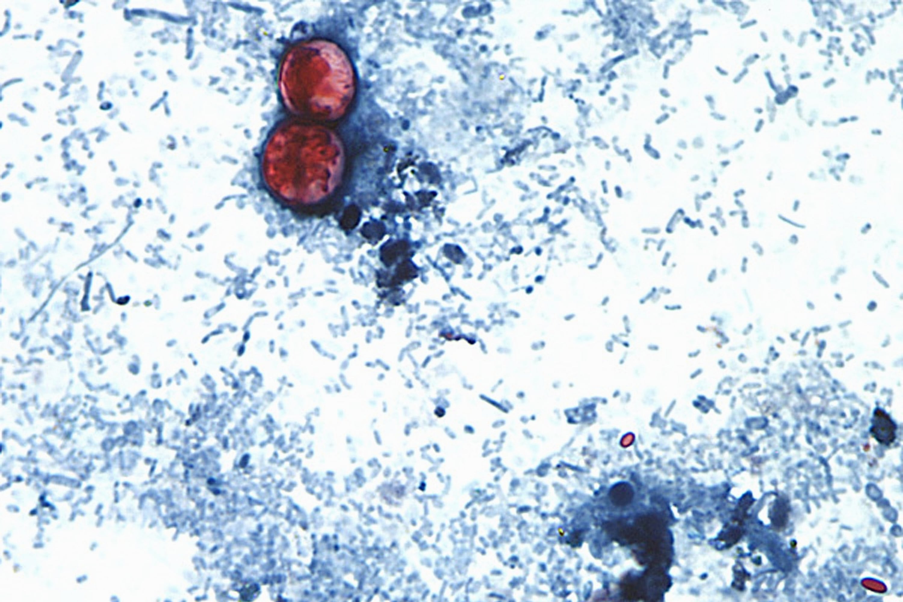Reportan las primeras muertes por ciclosporiasis en medio del brote en Estados Unidos