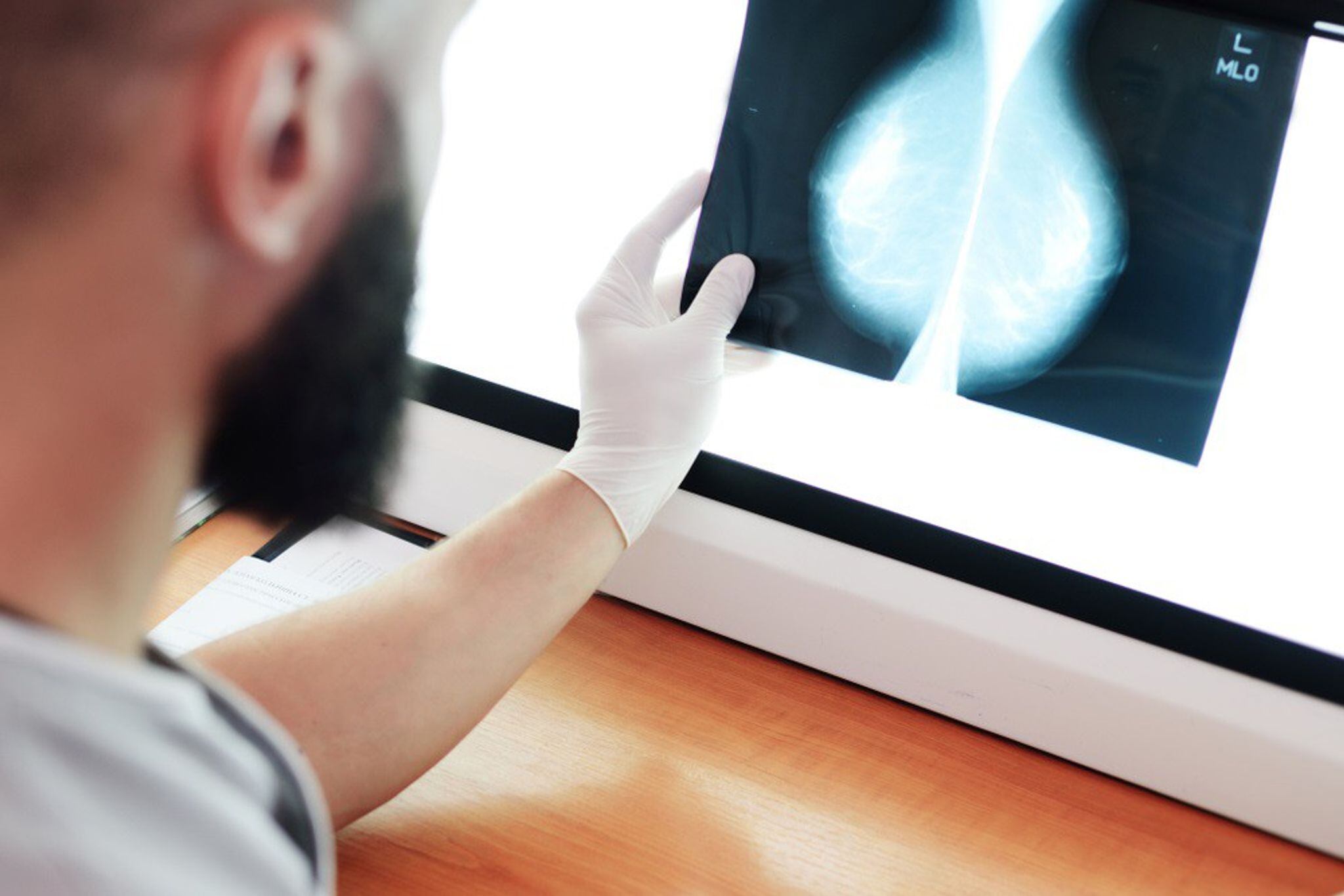 Los investigadores encontraron diferencias aun al comparar mujeres con factores de riesgo cardiovascular similares