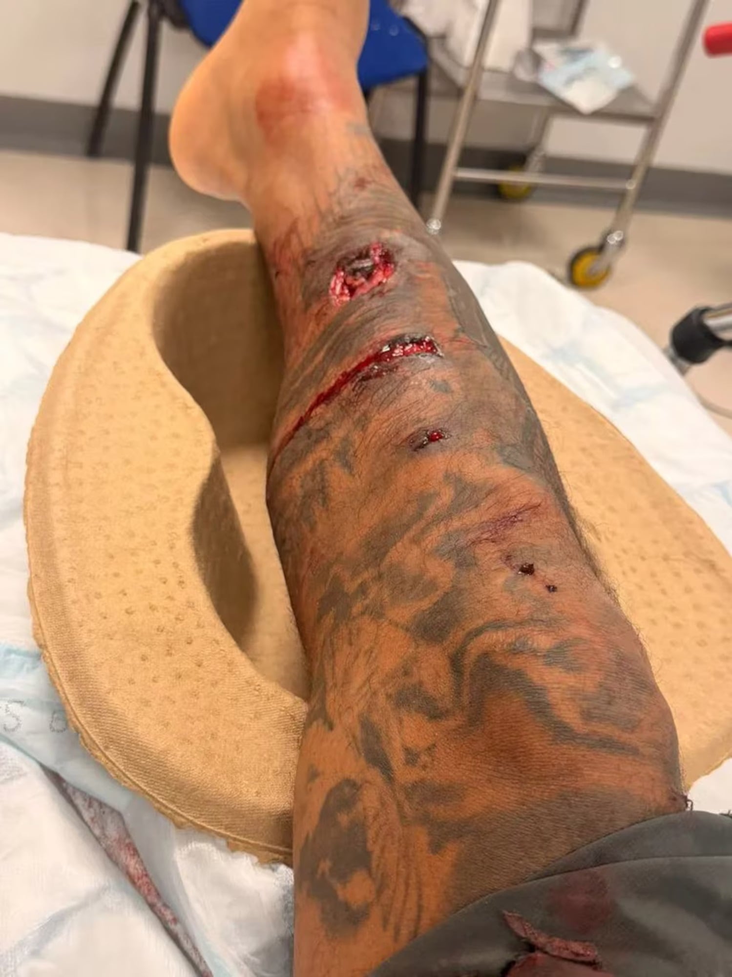 Jermaine Pennant mostró la gravedad de su lesión y fue viral en redes