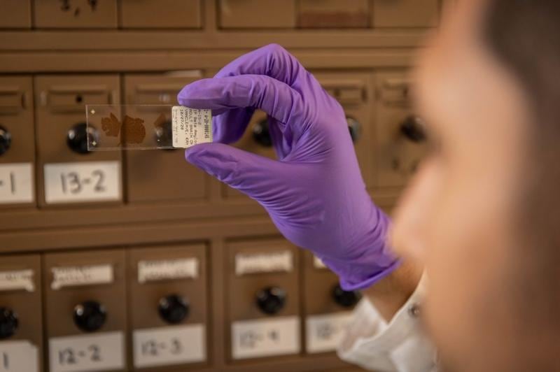 La cadena ligera de neurofilamento experimenta un incremento drástico en la sangre mucho antes de la fase sintomática
