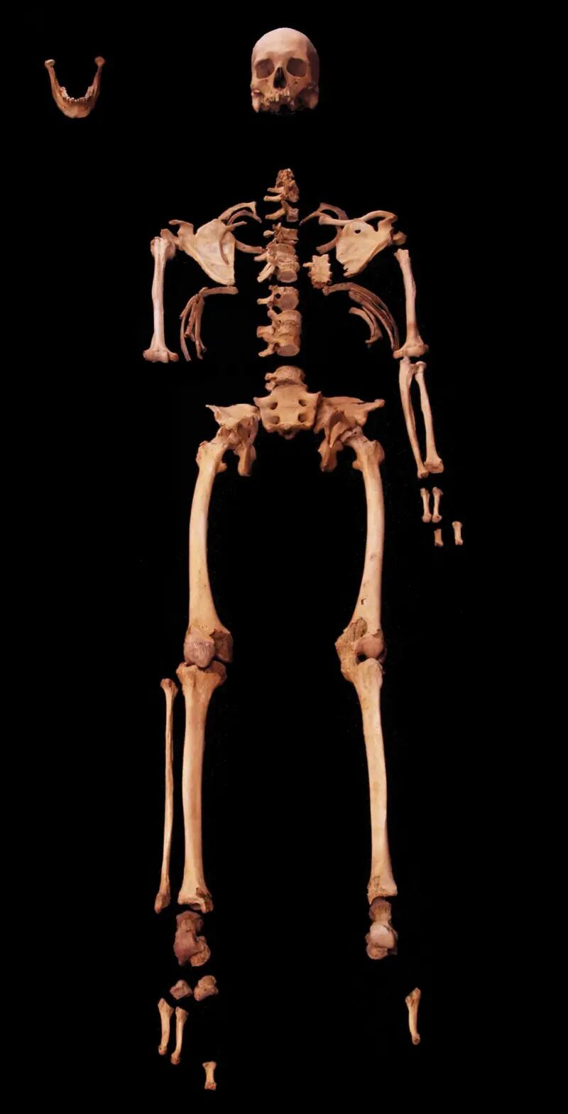 El esqueleto reveló detalles extraordinarios sobre la vida del hombre
