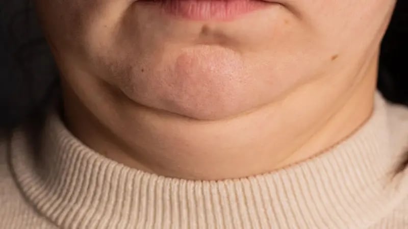 Si tu cuello se ve más grueso o más delgado de lo habitual, puede indicar algunos problemas de salud
