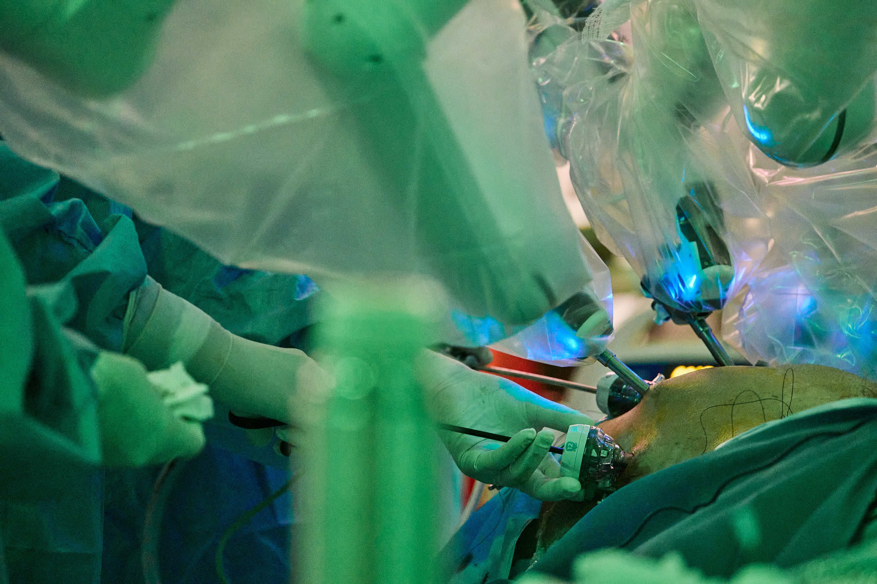 Da Vinci, el robot que transformó la cirugía del cáncer de próstata en mínimamente invasiva y despejó algunos de sus posibles riesgos