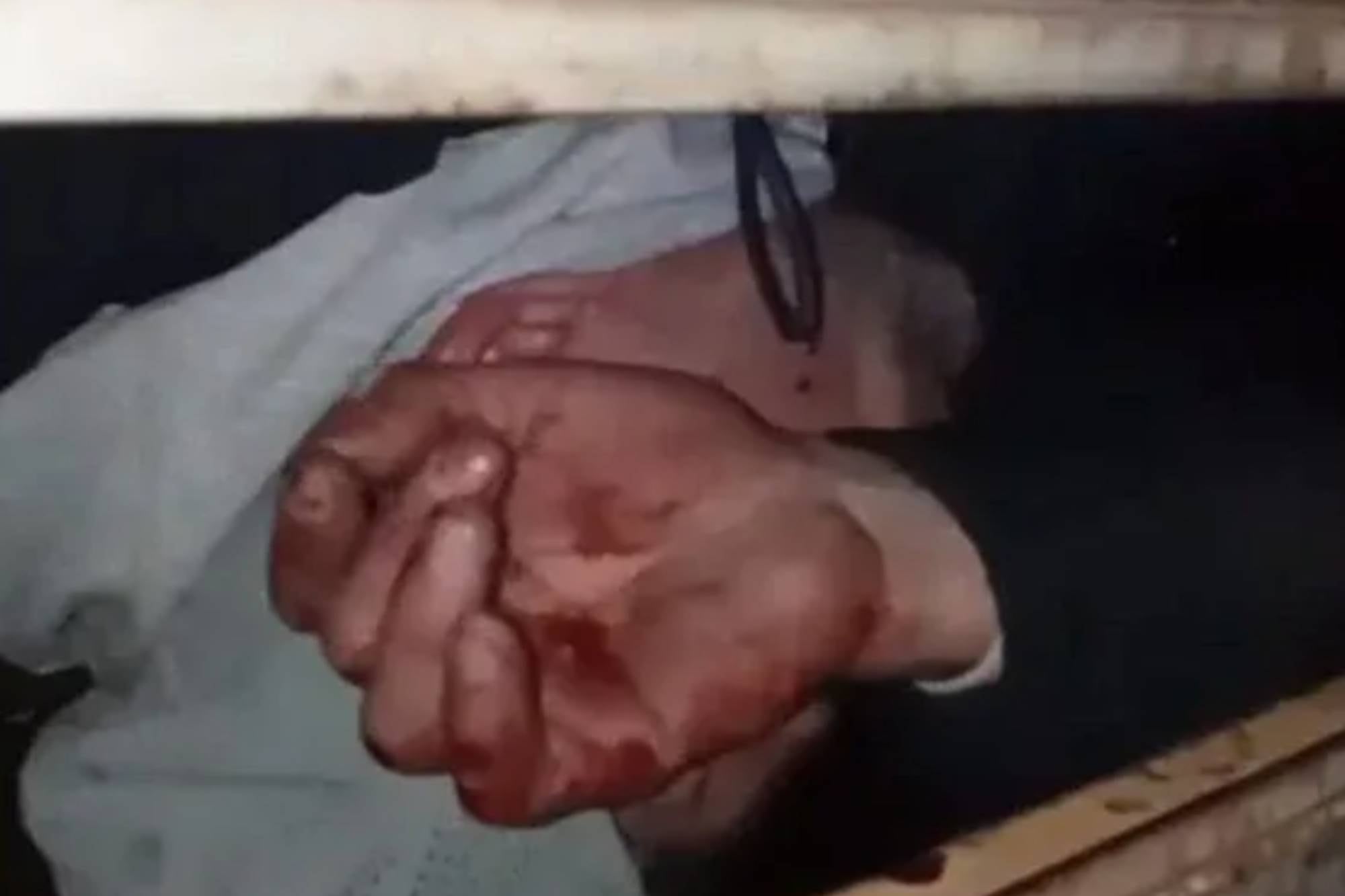 Un delincuente intentó entrar a robar en una casa en Mar del Plata, quedó atrapado en la reja y tuvieron que rescatarlo