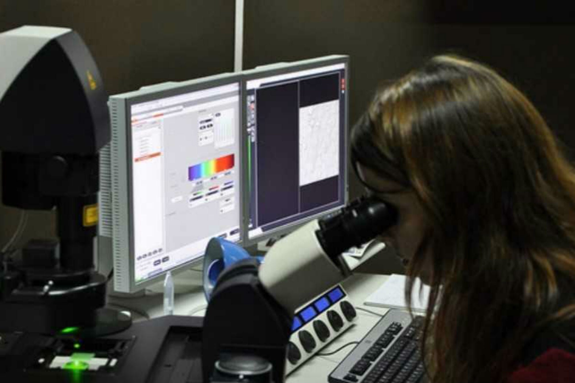 Dado que el diagnóstico concluyente en el país podría demorar cerca de un año, se resolvió enviar muestras del cerebro del animal a un laboratorio en España para acelerar los tiempos de respuesta