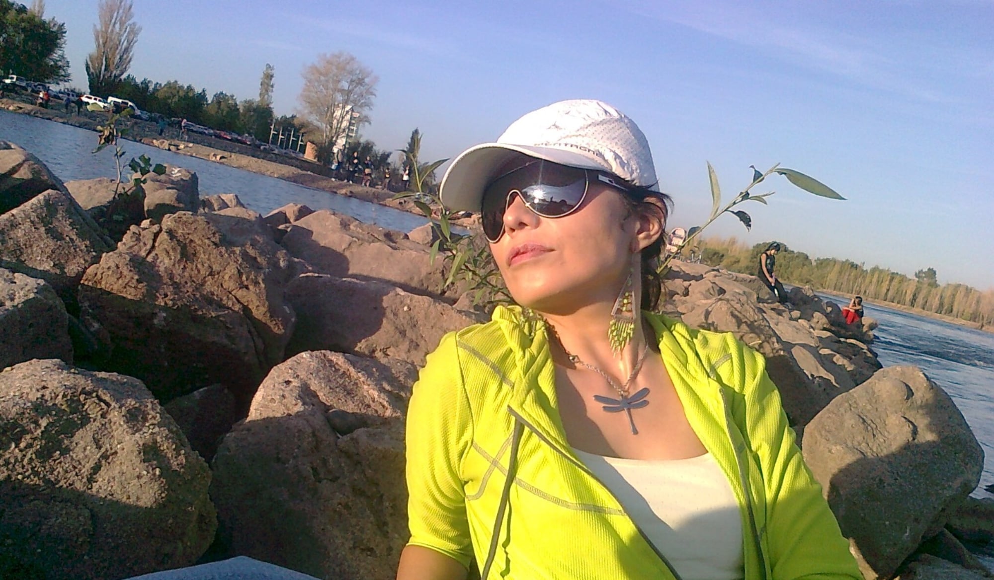 A Erika le colocaron una placa de titanio a los seis meses del accidente, una vez que la herida había cicatrizado lo suficiente para permitir la cirugía.