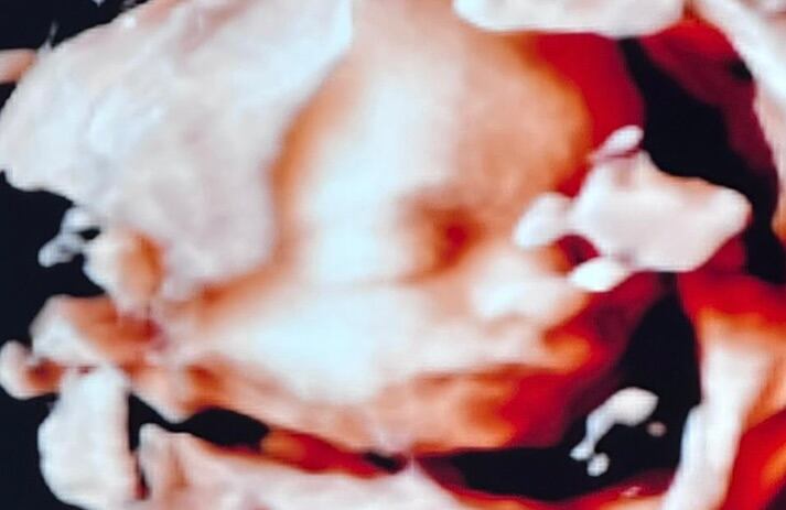 Milenka nacerá en Estados Unidos, al igual que su hermano Mirko