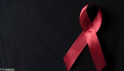 79,3 millones de personas se han infectado con el VIH desde el comienzo de la epidemia en 1981