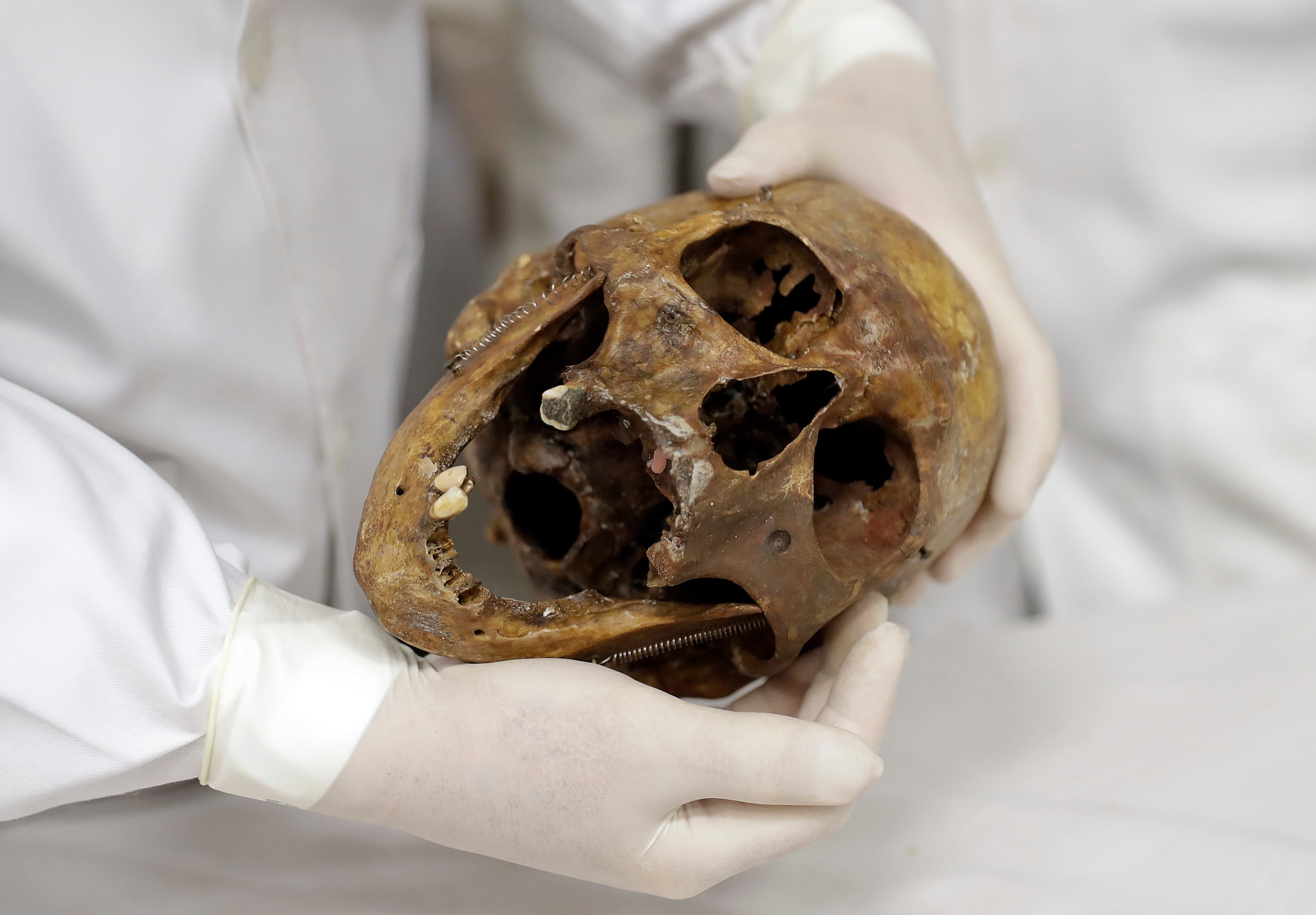ARCHIVO - En esta fotografía del sábado 7 de diciembre de 2016, el médico forense Daniel Muñoz muestra el cráneo del criminal de guerra nazi Josef Mengele, en la Facultad de Medicina de la Universidad de São Paulo, en São Paulo, Brasil. (Foto AP/Andre Penner, archivo)