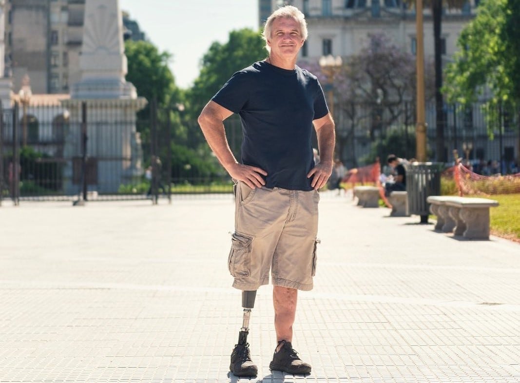 Festejaba un cumpleaños cuando estalló una bala de cañón: la explosión le arrancó una pierna y mató a su mejor amigo