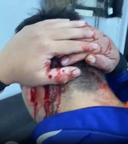 Con un machete y una cuchilla de carnicero intentaron un salvaje ajuste de cuentas en una barbería