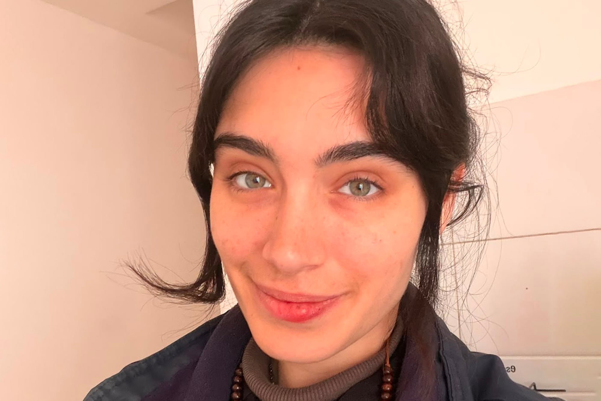 "Nunca había oído hablar de sífilis": los videos de una joven con la enfermedad que se hicieron virales y encienden alertas