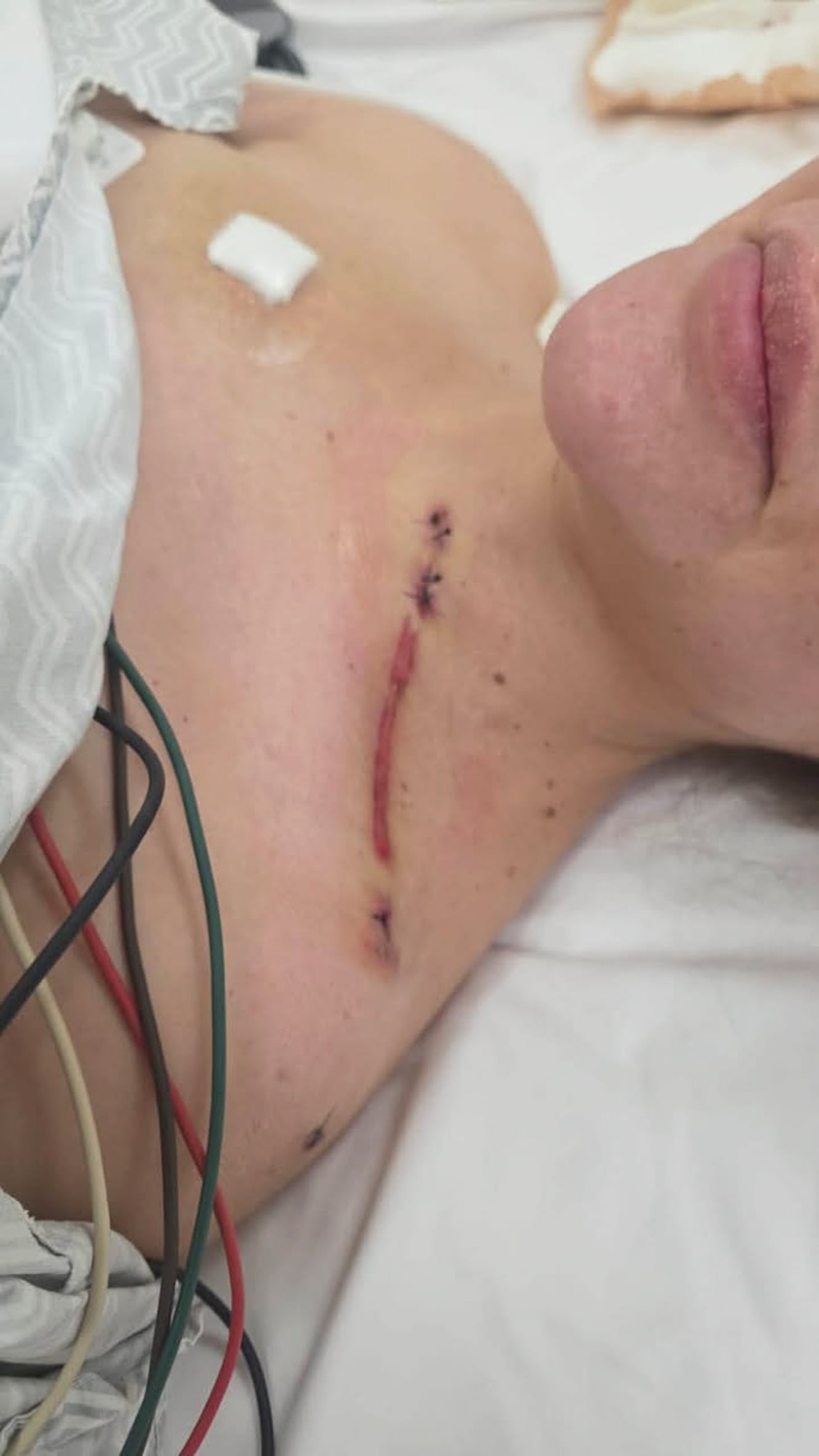 Una de las fotos que publicó Nadia Beller de sus heridas