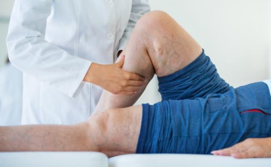 Los adultos mayores deben cuidar las articulaciones (Foto: El Tiempo)