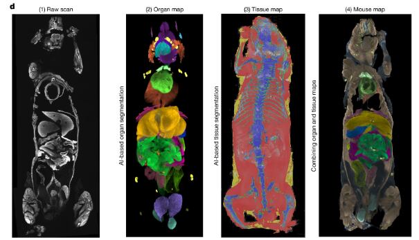 De izquierda a derecha, el sistema reconstruye el cuerpo completo a partir de imágenes crudas y aplica inteligencia artificial para identificar órganos, tejidos y generar un mapa anatómico integrado
