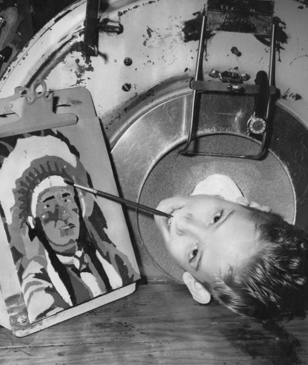 Paul Alexander sufrió polio a los seis años, dejándolo paralizado del cuello para abajo por el resto de su vida. Vivió dentro del pulmón de acero por más de seis décadas.