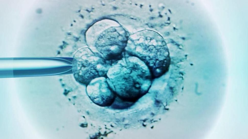 La técnica fue desarrollada en Reino Unido (Foto: Getty Images)