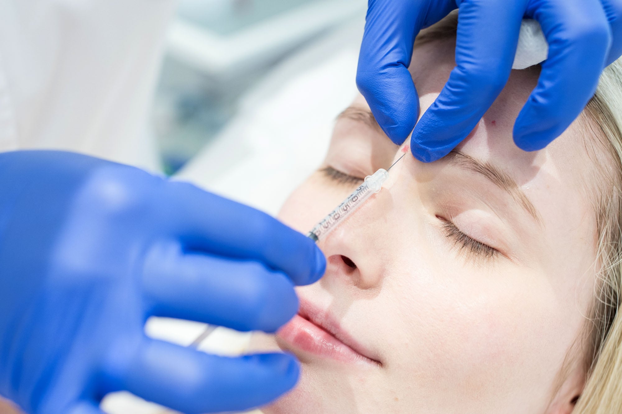 La toxina botulínica es conocida por su uso para atenuar o prevenir las arrugas