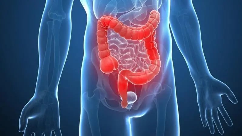 La colonoscopía permite identificar y extirpar pólipos antes de que evolucionen a tumor, y los estudios de detección temprana reducen significativamente la mortalidad