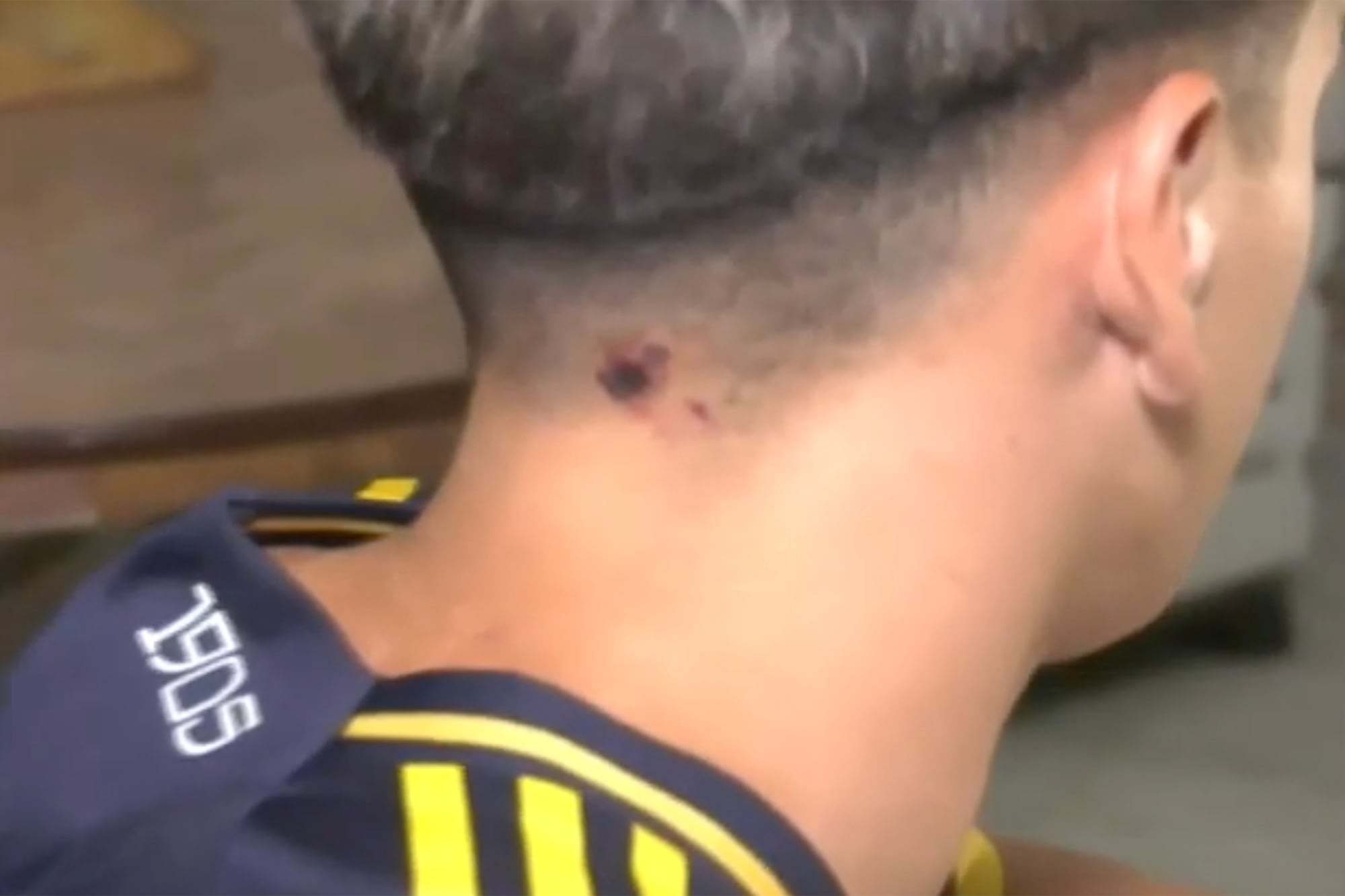 Luciano, el joven que fue herido por su novia, camino al colegio en San Martín