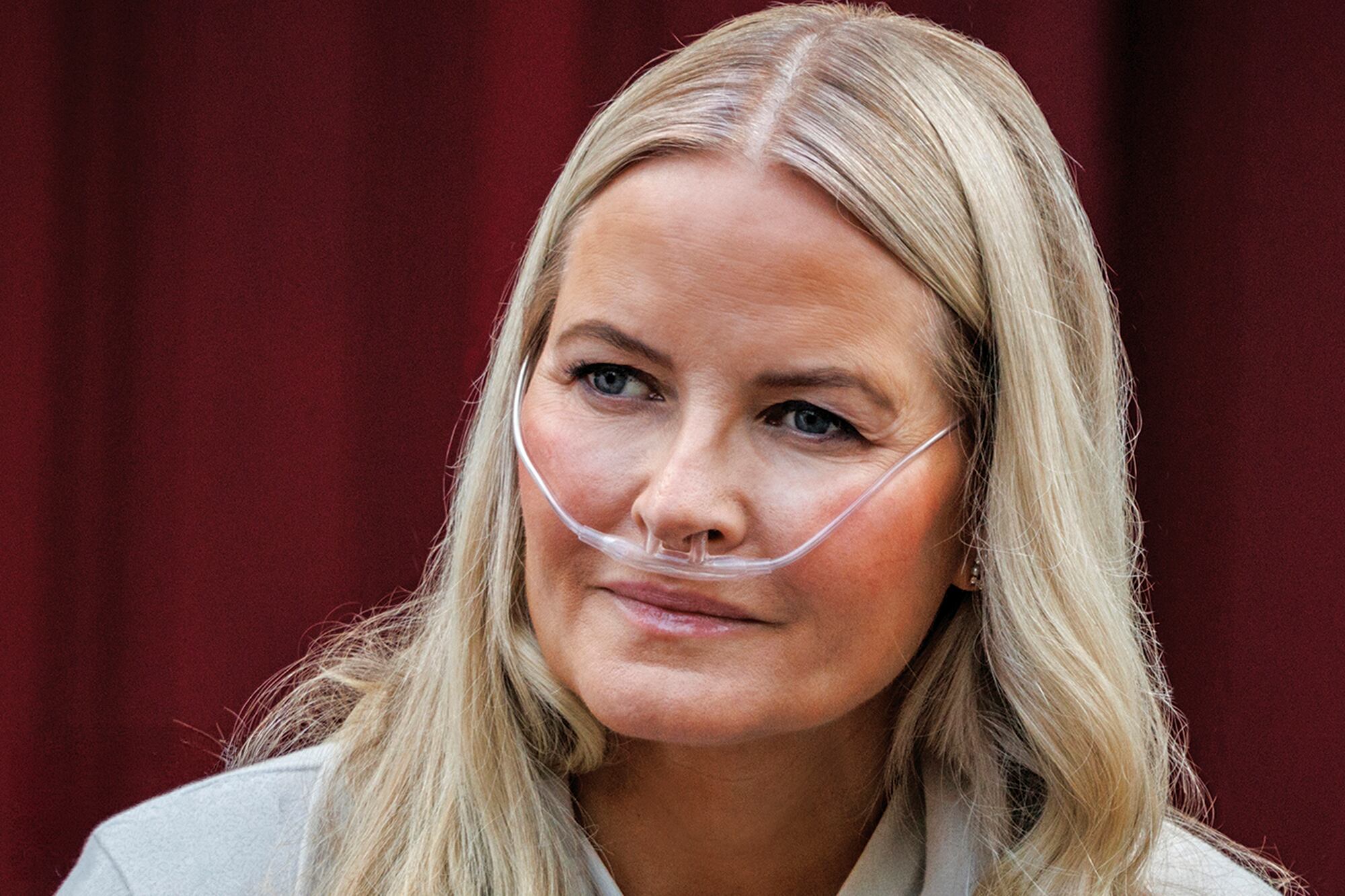 El neumonólogo de Mette-Marit advierte que la princesa necesita un trasplante de pulmón con urgencia