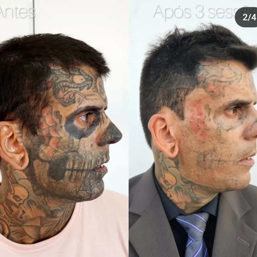 El proceso de cambio de Leandro tras las primeras cirugías