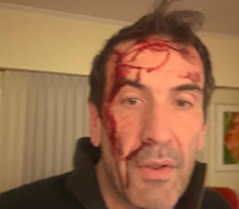 Un candidato a senador de LLA por Neuquén denunció que sufrió una entradera en su casa y fue golpeado