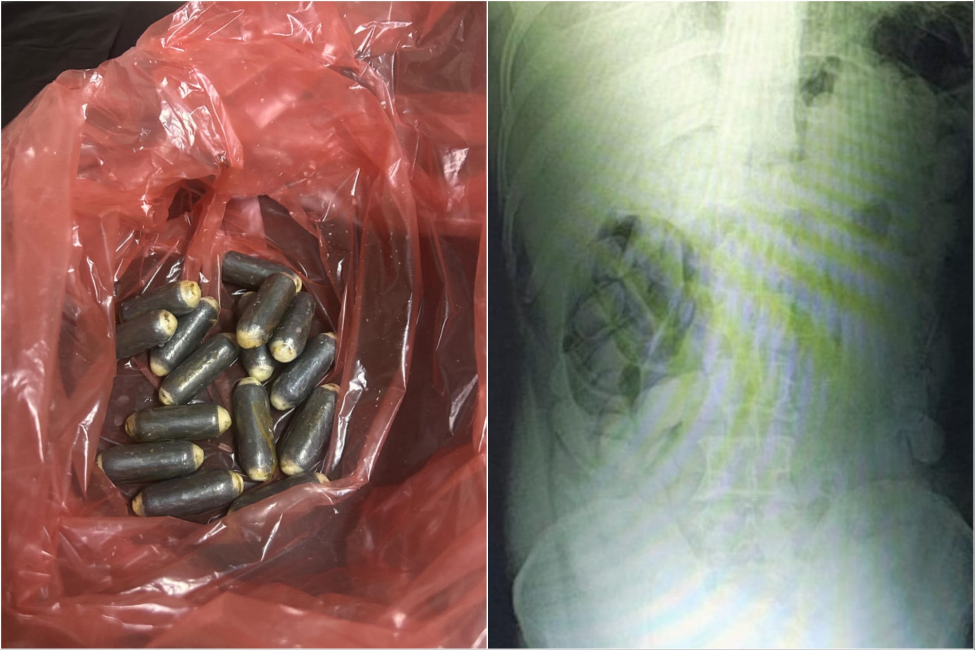 Gendarmería detuvo a dos "mulas" que viajaban en un micro: habían ingerido más de dos kilos de droga en 188 cápsulas