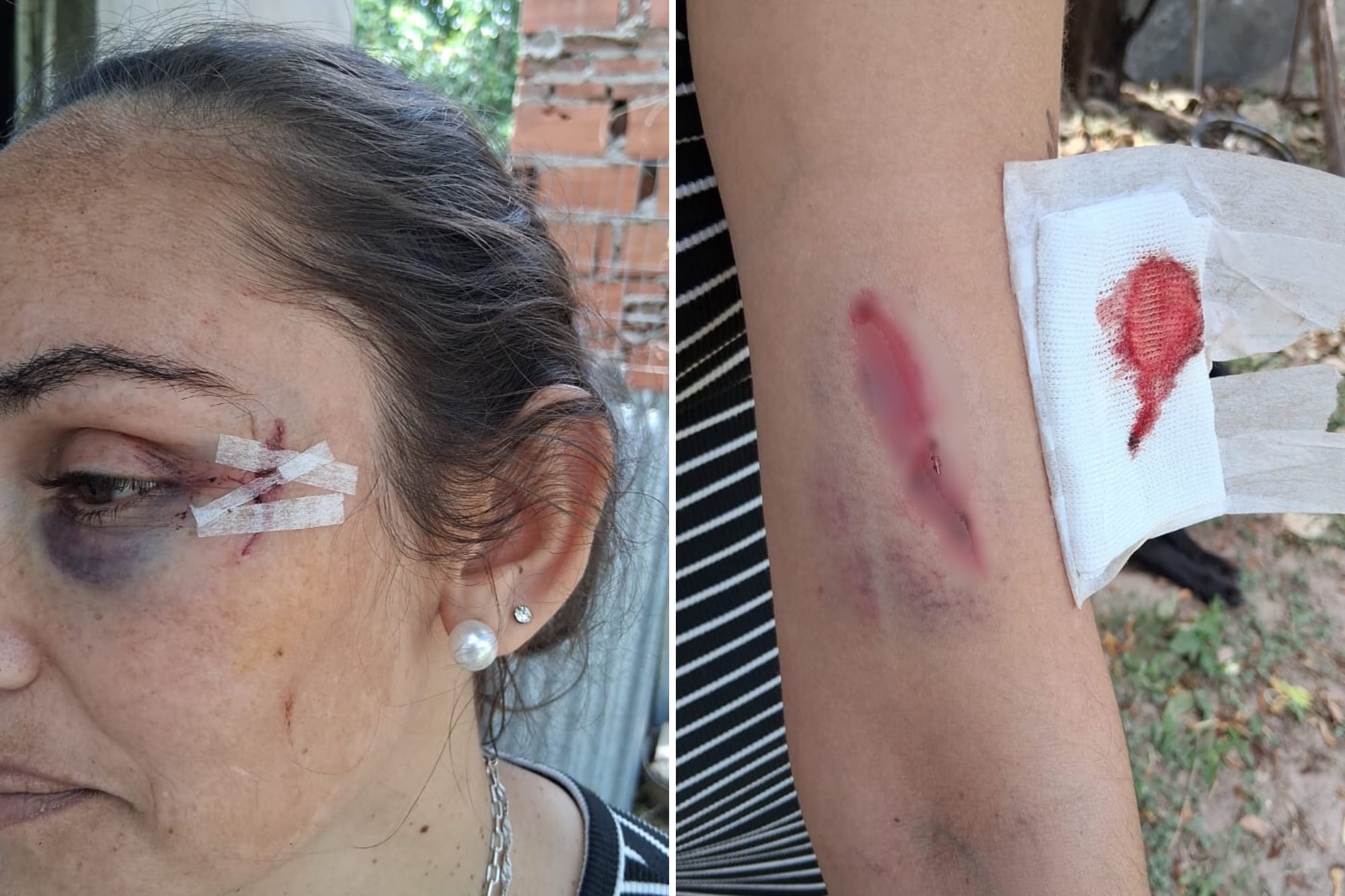 Dos mujeres intentaron matar a la hermana de un intendente de Santa Fe y quedaron detenidas