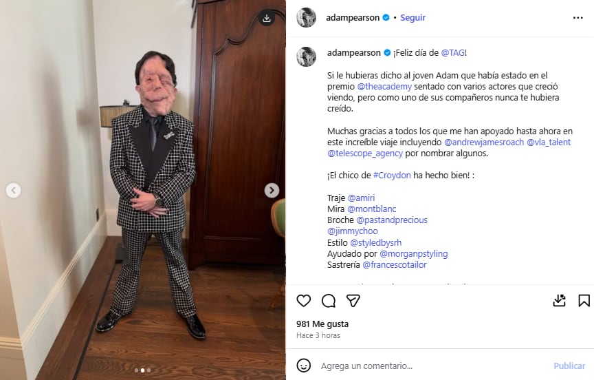 El posteo de Adam Pearson que se viralizó en Instagram