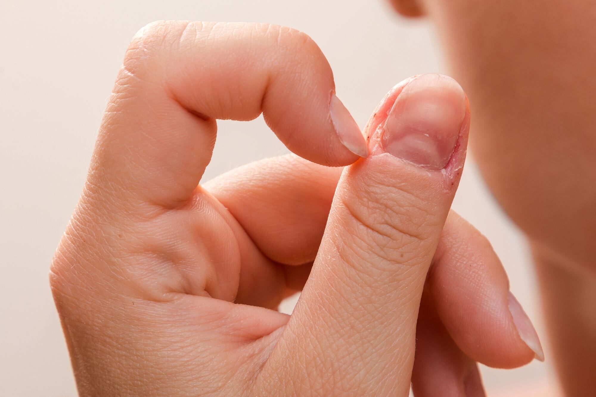 Abordar la onicofagia implica mirar más allá del gesto y comprender qué función cumple en la vida de la persona