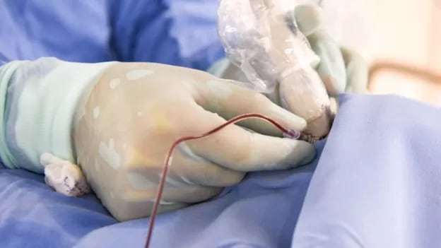 Cerca de cuatro de cada diez casos de cáncer están vinculados a factores de riesgo prevenibles, como el tabaquismo, la obesidad y algunas infecciones