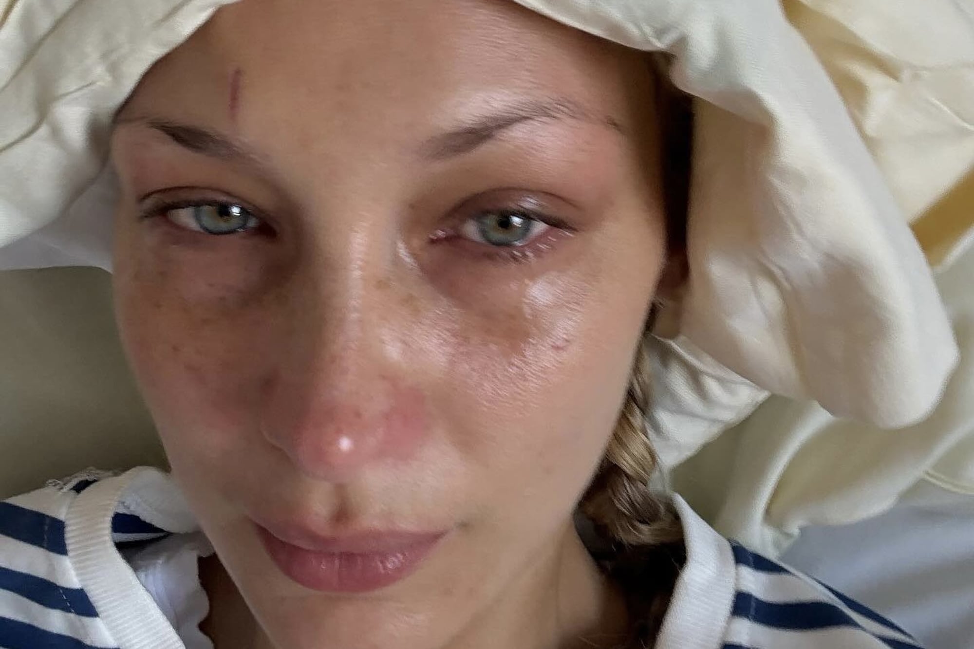 Una de las imágenes compartidas por Bella Hadid en sus redes sociales