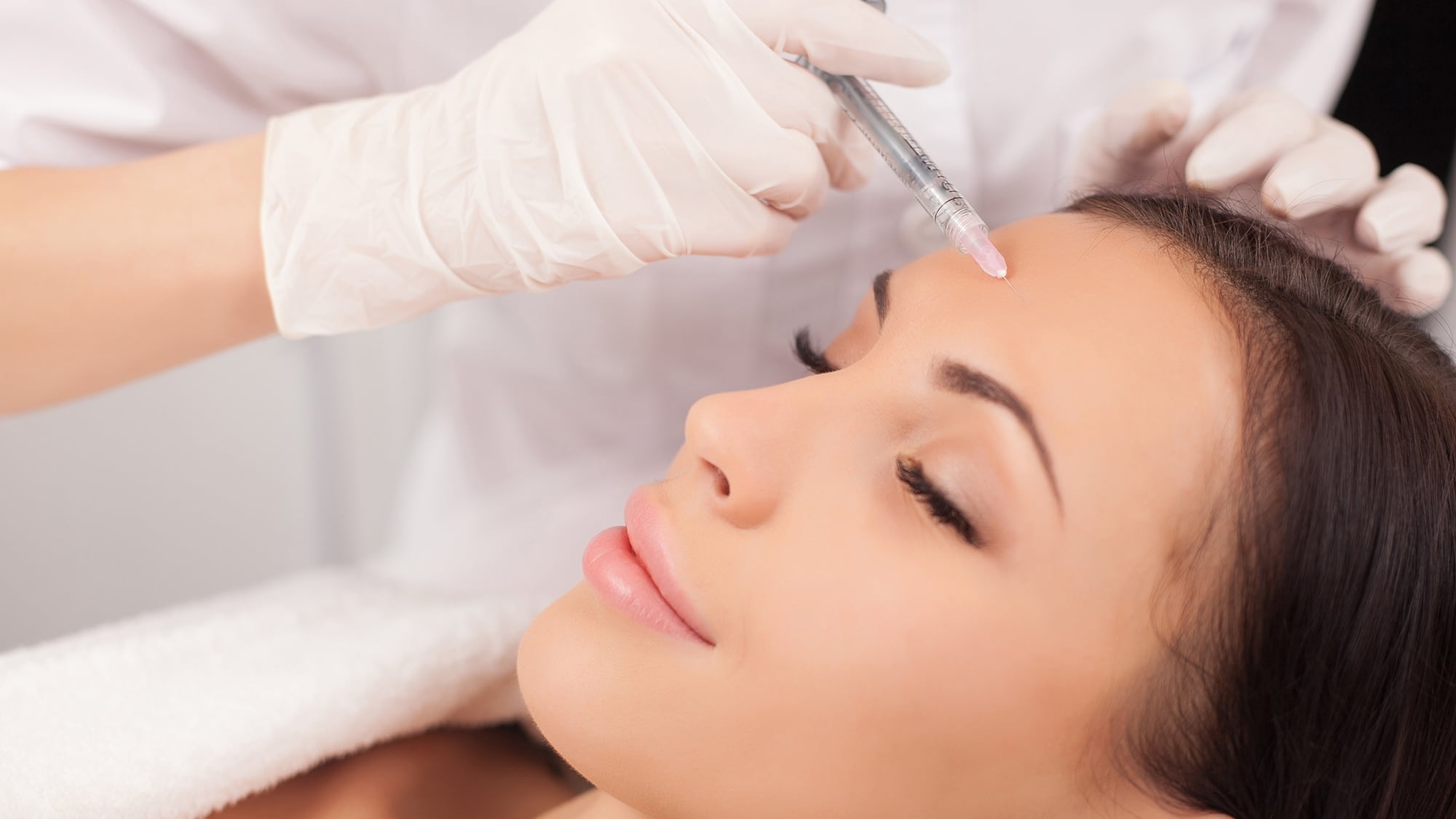 El uso habitual de bótox son 50 unidades mientras que en el baby bótox se utilizan entre 15 y 20 unidades