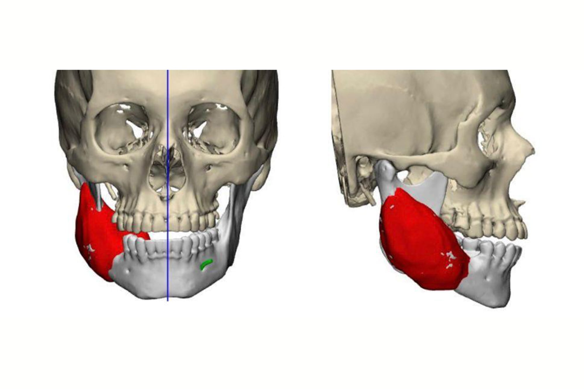 La tecnología permite disminuir las secuelas y agilizar los tiempos de operación y recuperación del paciente