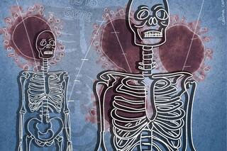 Los esqueletos de 1918 que revelaron pistas de quiénes era más propensos a morir en una pandemia