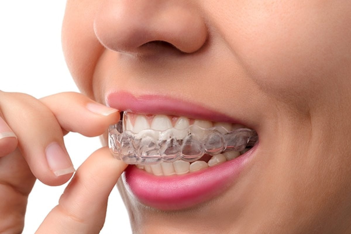 El uso de protectores bucales no eliminan el rechinamiento, pero previenen el daño dental