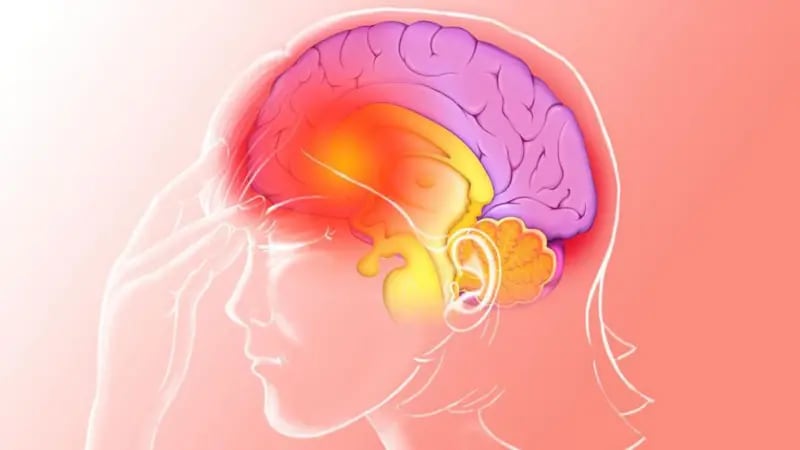 Uno de los desafíos de estudiar la migraña es la amplia gama de síntomas que puede presentar