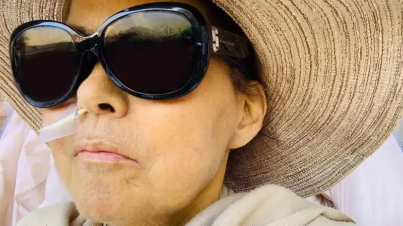 La piel de Caroline se puso amarillenta mientras esperaba un trasplante