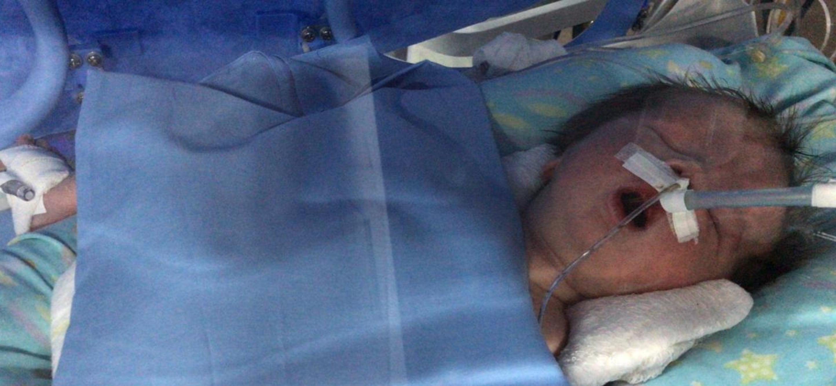 Le dieron un diagnóstico irreversible pero lucharon y su hijo logró avances extraordinarios: “No va a caminar, no va a hablar, no va a comer” 6 Milo nació con una hipoxia severa. No podía respirar por sus propios medios, estaba azul y sin tono muscular.