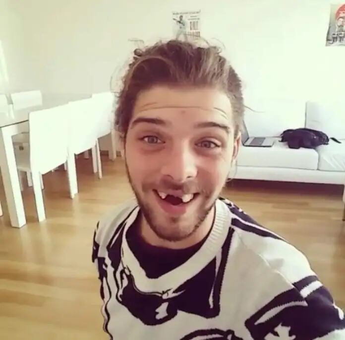 El rostro de Maratea sin sus dientes frontales