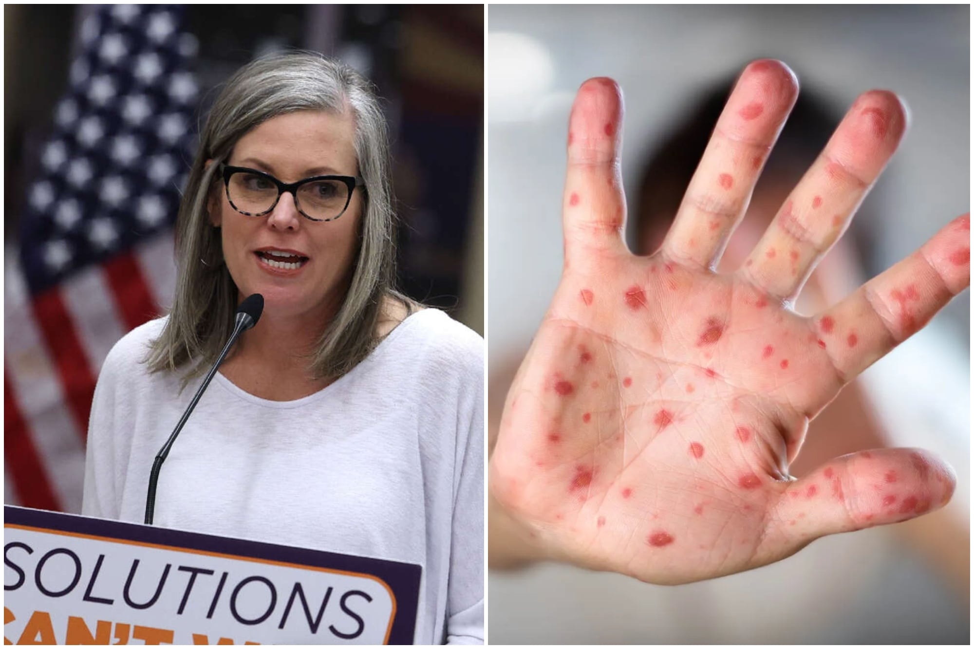 Alerta en Arizona: la enfermedad “altamente contagiosa” que se propaga en el estado y que preocupa a Katie Hobbs