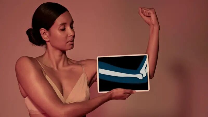 El calcio es solo uno de varios nutrientes esenciales para la salud de nuestros huesos